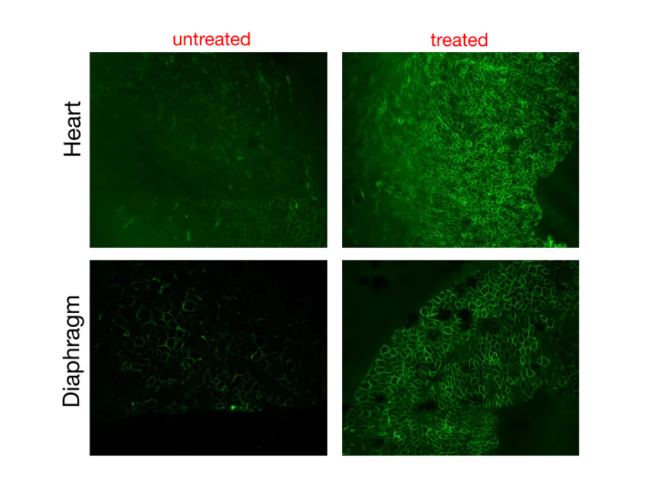 Restoration of dystrophin protein in humanized mdx mice. Green shows dystrophin at the membrane of dystrophic muscles.